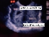 Ultrasound pic, I'm having twins!! This is them next to each other!