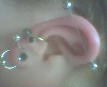 ear 1