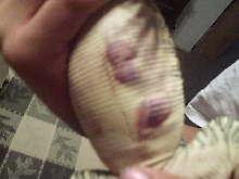sickening blisters