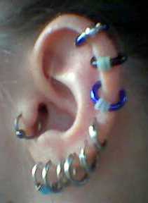 Left Ear