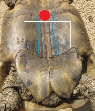 plastronotomy