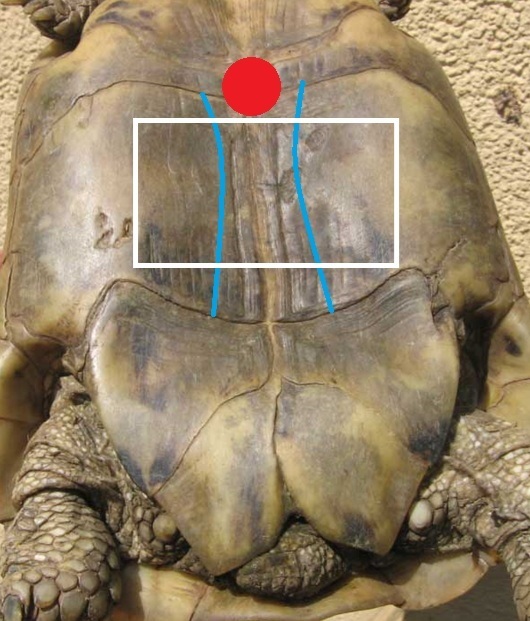 plastronotomy