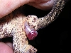 prolapse1