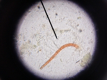 Mantella Expectata Fecal w/ parasite ???