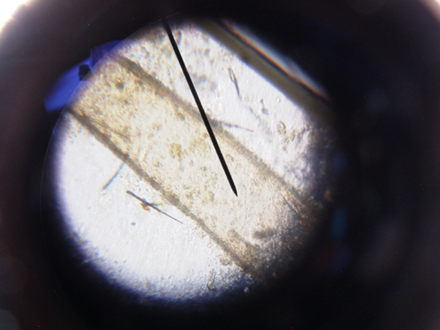 Mantella Expectata Fecal w/ worms 1200x