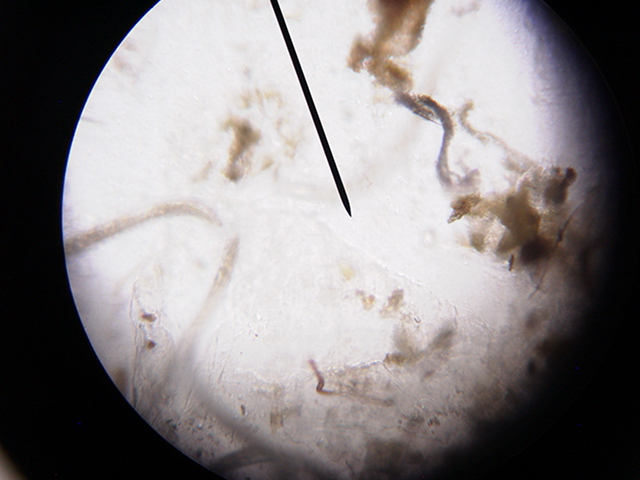 Mantella Expectata Fecal w/ worms 2