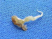 Is This A Sperm Plug
