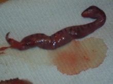 Dead Embryo Belly