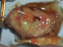 Inside Egg