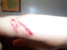 Opps! 2