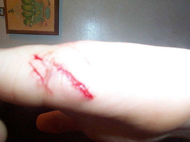 Opps! 2