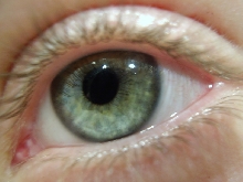 my eye! explenation inside