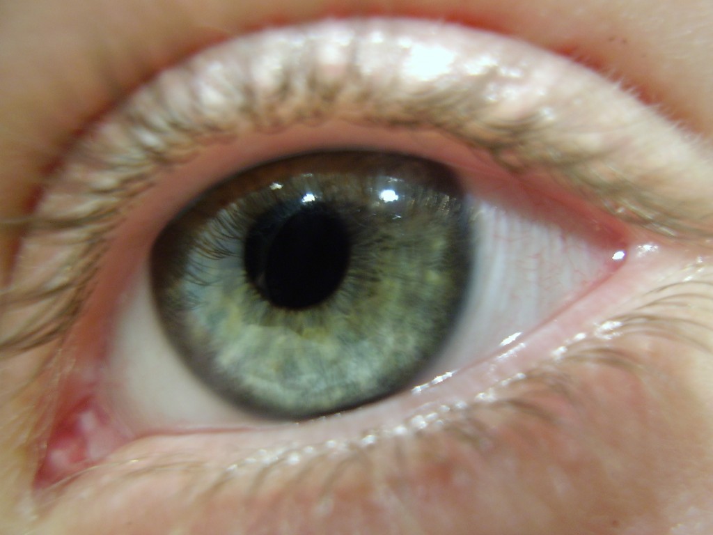 my eye! explenation inside