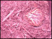 Frog aestivation