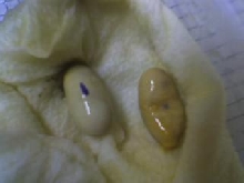 Eggs