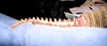 Rat Bites on a Savy