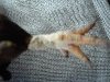 bad legs