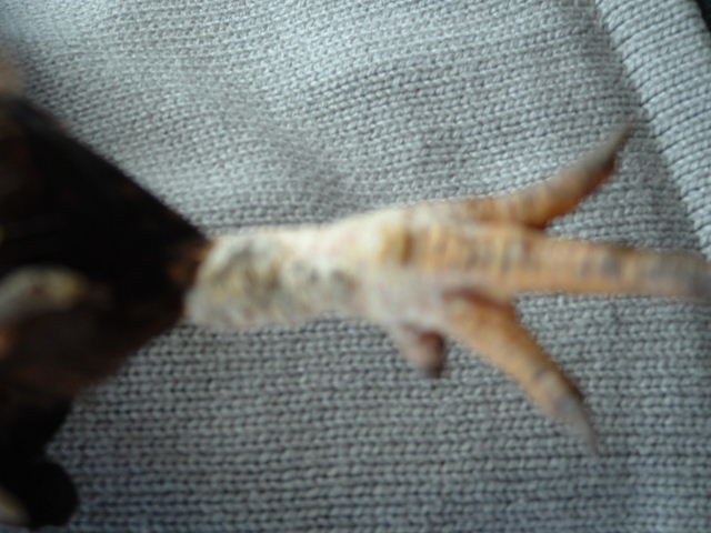 bad legs