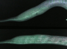 xray