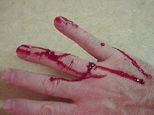 blood python bite