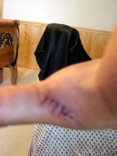baby savanah monitor bite