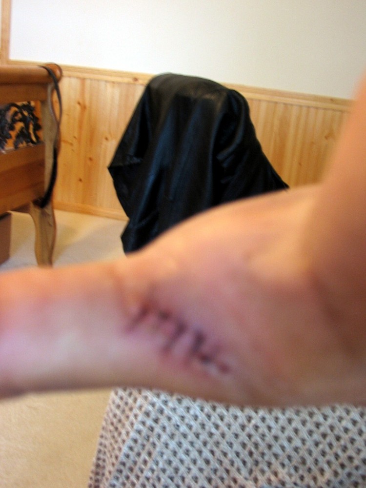 baby savanah monitor bite