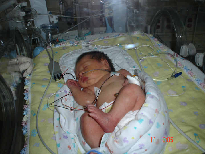 Grace Incubator