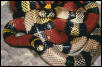 anery. & norm. L.t. micropholis