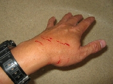 Bite from jungle carpet python