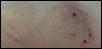 JCP bite after washing off blood