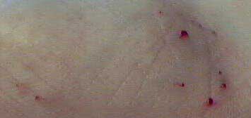 JCP bite after washing off blood