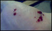 closeblood