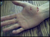 bitehand