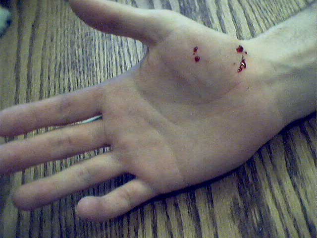 bitehand