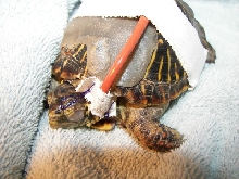 Feeding Tube