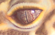 Eye