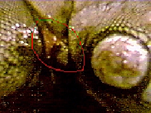 side throat1
