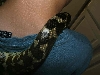 skin problem 3