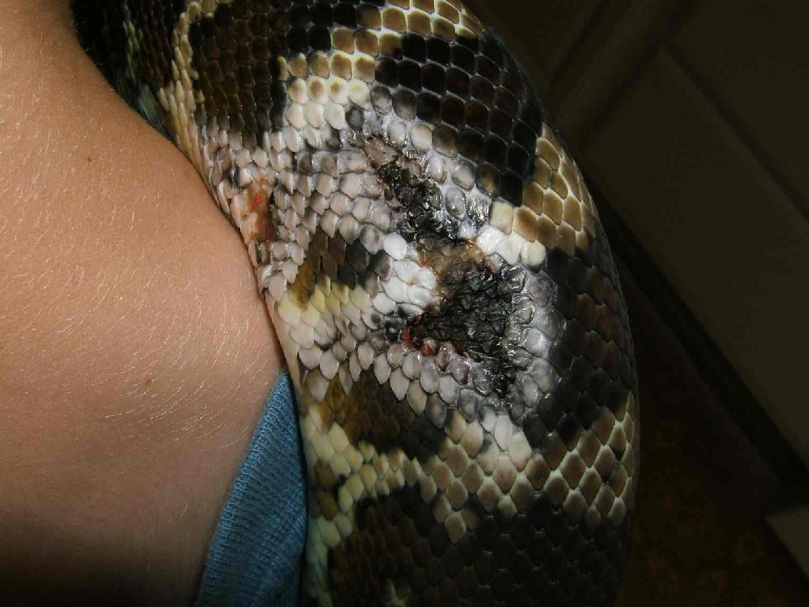 skin problem 4