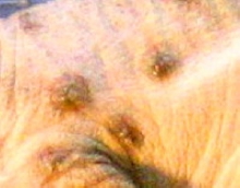 pox
