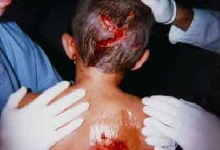 chondr python bite