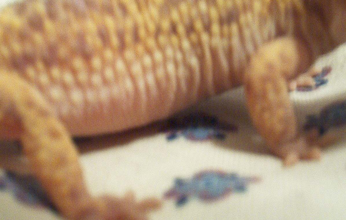 gravid side