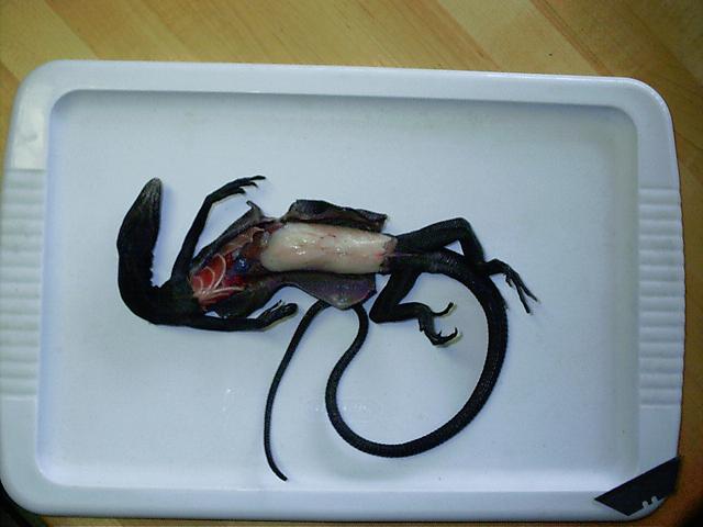 autopsy