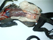 autopsy