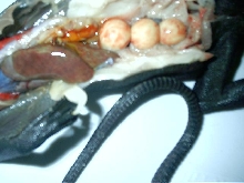 autopsy