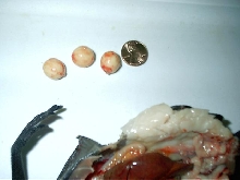 autopsy