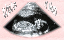 My Daughter to be at 19 weeks
