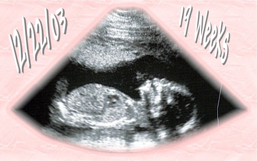 My Daughter to be at 19 weeks
