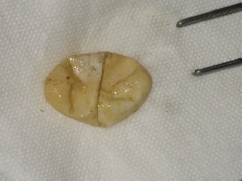 beccarii egg3