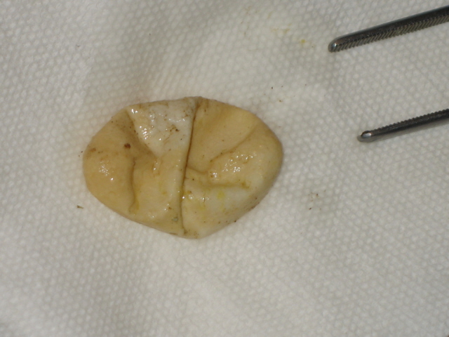 beccarii egg3